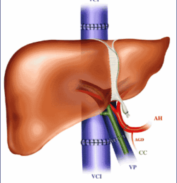 Histoire de la transplantation par J.Lerut